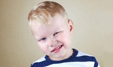 سندرم تورت
