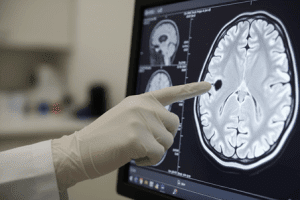 کاربرد اسکن سه‌بعدی مغز در روانشناسی و نوروتراپی